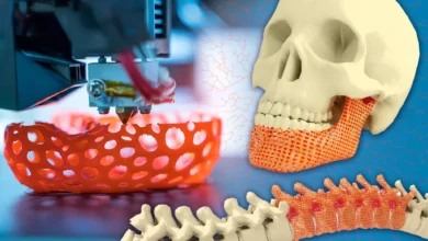La impresión 3D y las nuevas posibilidades que ofrece en la Cirugía plástica