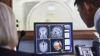 Inteligencia Artificial ayudaría a detectar el envejecimiento acelerado del cerebro que está relacionado con el Alzheimer