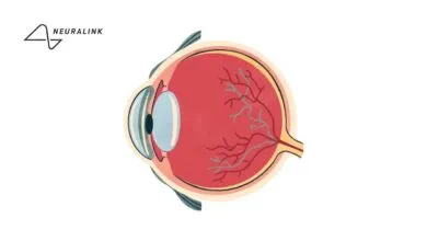 Neuralink quiere devolver la vista a los débiles visuales con Blindsight